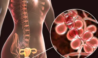 Avances en el tratamiento de la infertilidad causada por la endometriosis