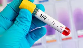 ¿Cuál es la diferencia entre VIH y Sida?