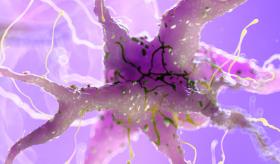 El alcohol sigue dañando el cerebro incluso cuando ya se ha dejado de beber