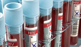 Los NIH invierten 14,6 millones de dólares en investigación que busca la cura del VIH