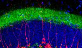 Los beneficios cognitivos de la práctica deportiva se heredan
