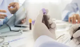 VIH podría provocar sintomatología neurológica en población femenina