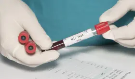 Vacuna contra el VIH en fase 3 tras muchos años de estudio