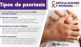 Tipos de Posiriasis