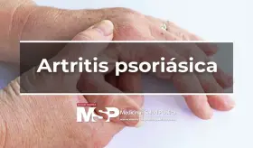 Artritis psoriásica
