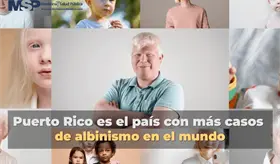 Puerto Rico es el pa&iacute;s con m&aacute;s casos de albinismo en el mundo