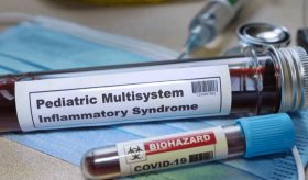 Síndrome inflamatorio grave en niños contagiados con COVID-19
