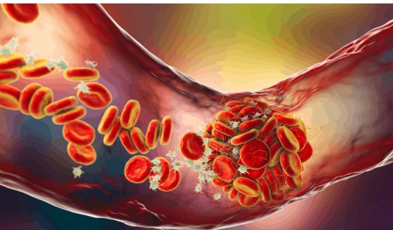 Desarrollan un fármaco proteico para la hipertensión arterial pulmonar