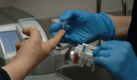 Continúan los esfuerzos en investigaciones clínicas contra la Diabetes tipo 2 