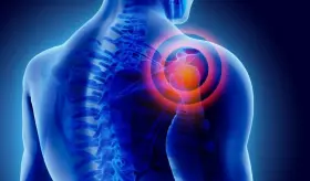 El uso habitual de inyecciones de corticoides es seguro para el dolor de hombro