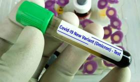 Los primeros informes sobre la variante Ómicron son alentadores, según el Dr. Anthony Fauci