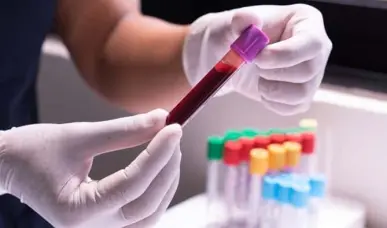 La estrategia de Estados Unidos para erradicar la epidemia del HIV