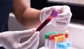 Reducción de las pruebas del VIH durante la pandemia aumentan las preocupaciones sobre la transmisión