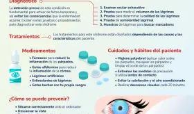 Síndrome del Ojo Seco - Infografía