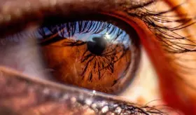 Síntomas oculares en pacientes con rosácea