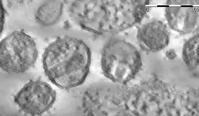 El tercer paciente curado de VIH deja esperanzas en la medicina para la lucha contra la enfermedad