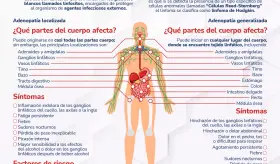 Linfoma Hodgkin vs Linfoma no Hodgkin