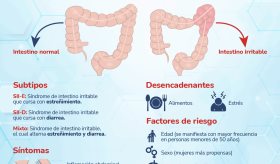 Síndrome de Intestino Irritable - Infografía