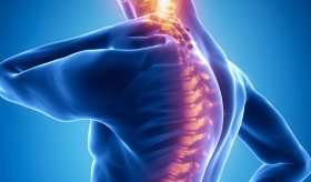 Directrices actualizadas sugieren movilización temprana de lesiones espinales