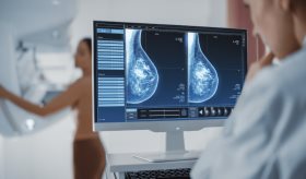 La vitamina D baja se relaciona con el riesgo de cáncer de mama en mujeres hispanas