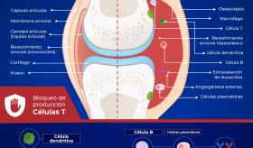 Bloqueo co-estimulatorio de células T como tratamiento de la artritis reumatoide.