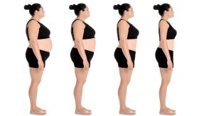 Obesidad, nuevo fármaco tan eficaz como la cirugía bariátrica