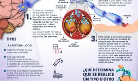 Cuales son los principales tipos de anestesias - Infografía
