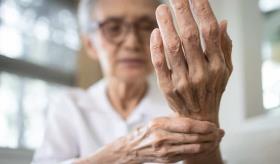 ¿Cómo se diagnostica la artritis reumatoide y cuándo acudir al médico?