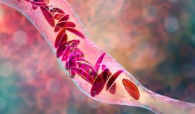 ¿Qué causa la anemia y cómo detectar sus síntomas? 