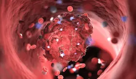 Odisea de niña diagnosticada con SHUa, una enfermedad ultrarara que ataca los vasos sanguíneos