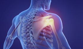 La fibromialgia no es igual al dolor crónico, aquí te explicamos las diferencias