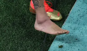 Mundial de Qatar: lesiones en futbolistas son musculares en el 60 % de los casos