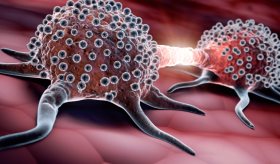 Aumenta la incidencia del mieloma múltiple en todo el mundo