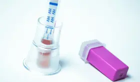 Test rápidos para identificar el VIH son claves para aumentar las tasas de diagnóstico