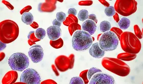 Células puñal: nueva terapia contra la leucemia linfoblástica aguda de células T, con resultados positivos