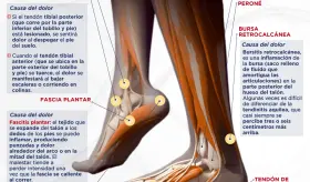 Conozca las partes del tobillo y pie para identificar el dolor