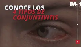 Conoce los 4 tipos de conjuntivitis #CápsulaEspecial