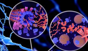 Nuevo fármaco experimental contra el alzhéimer puede retrasar el deterioro cognitivo en un 35 %
