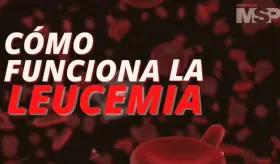 ¿Cómo funciona la leucemia? - #ExclusivoMSP