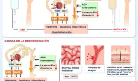 Causas y efectos de la deshidratación e hiperhidratación - Infografía