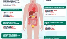 Compuestas de pérdidas continuas líquidos en niños y adolescentes | Infografía