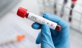 ¿Cuándo el VIH progresa a SIDA? Diferencias, tratamiento antirretroviral y todo lo que debe saber