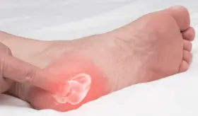 Dolor punzante en el pie: Identifique el espolón calcáneo y otros tipos de espolones en el talón