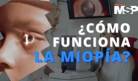 ¿Cómo funciona la miopía? - #ExclusivoMSP