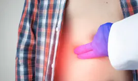 ¿Dolor en la costilla? Conozca el síndrome de costilla deslizante