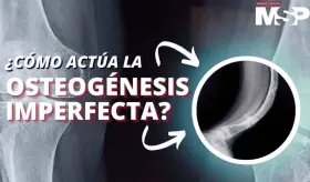 ¿Cómo actúa la osteogénesis imperfecta?