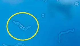 Moscas volantes: una afección ocular que puede señalar un desprendimiento de retina