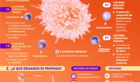 Leucemia | Infografía