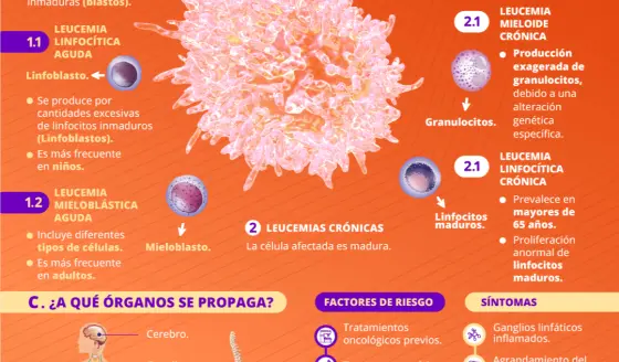 Leucemia | Infografía