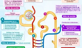 Diuréticos y nefrona | Infografía